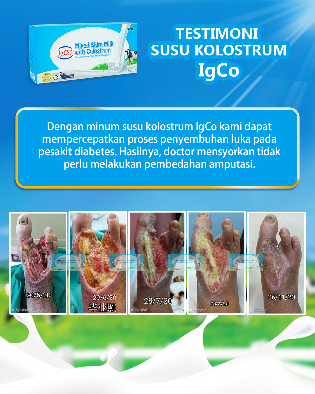 luka kencing manis